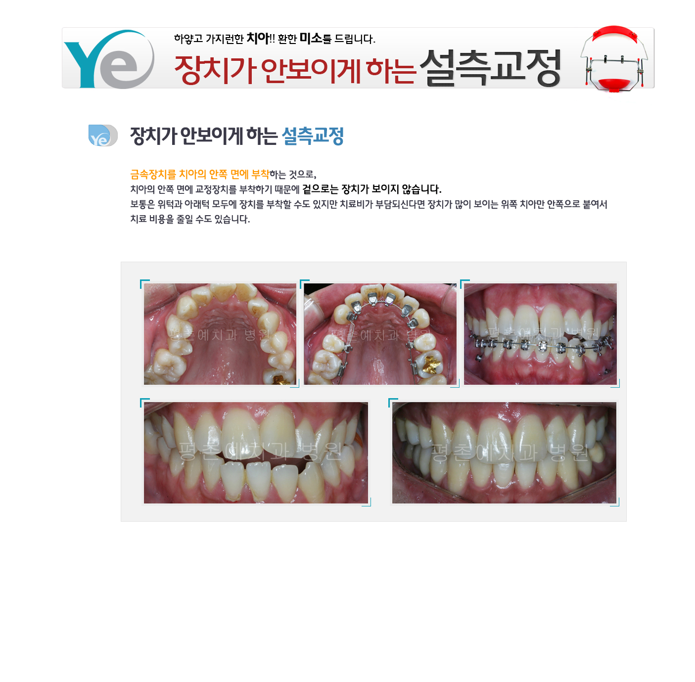 곻